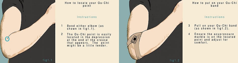 qu-chi acupuncture point the Hayfever Band
