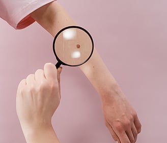 Allergy Testing Melbourne​