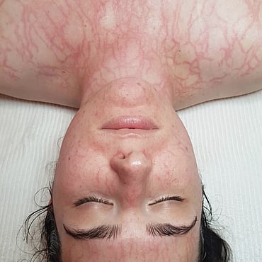 Observ Skin Analysis – Body Beautiful Retreat – Brisbane