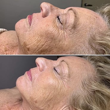 Observ Skin Analysis &ndash; Body Beautiful Retreat &ndash; Brisbane