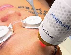 Introducing our new Technology - Aerolase Neo Elite