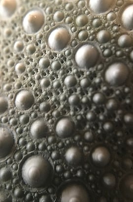 Types of Skin Cancer