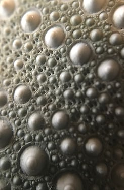 Types of Skin Cancer