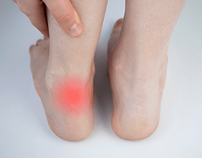 Why Your Achilles Pain Isn&rsquo;t Healing