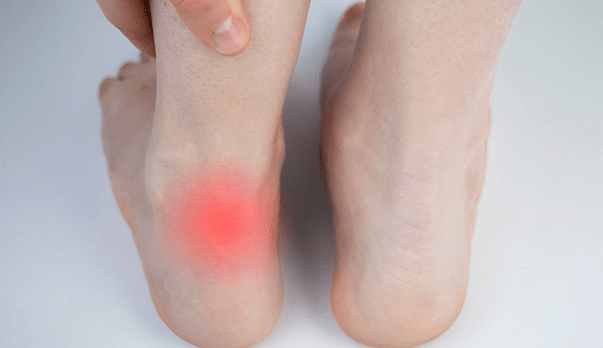Why Your Achilles Pain Isn&rsquo;t Healing
