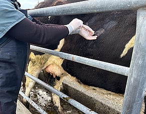 A look at liver biopsies