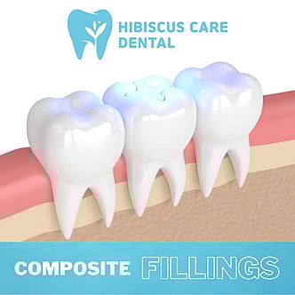 Dentist Whangaparaoa