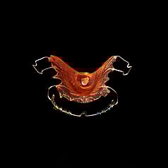 Custom made oral device, transparent red in colour. The palet piece has a central hole surrounder by a raised inner rounded lolly shaped impression to stimulate the wearers tongue to swallow. The retainer plate is fashioned with wire attachments that clip onto teeth. Also a front wire that slips on between the top lip and gums which has eight tiny beads threaded into it to stimulate the wears lip muscles. This oral device is centrally positioned on a square black background.