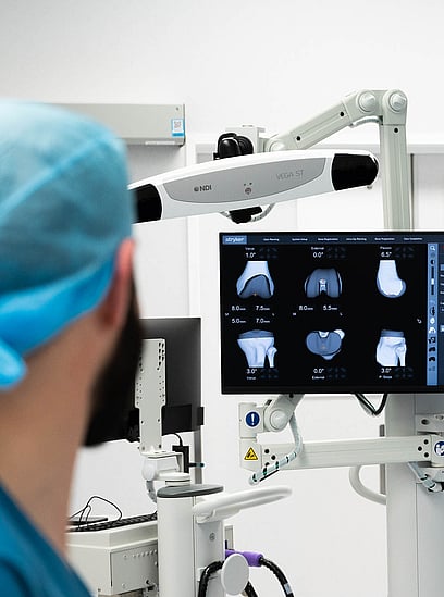 Hamish McLaren looking at a screen displaying knee joint images during a robotic-assisted surgery in an operating room.