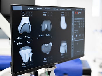 X-ray illustration of a human knee joint, showing detailed outlines of the femur, tibia, and patella, against a dark background.