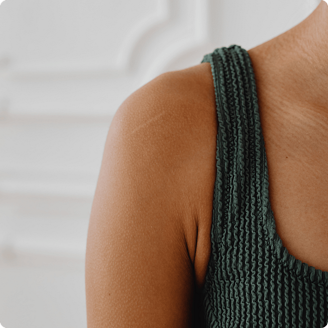Hyperhidrosis  photo of woman's shoulder