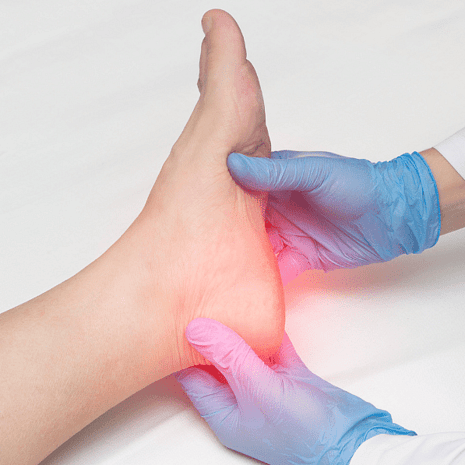 Specialist podiatry and physiotherapy care for heel pain including plantar fasciitis, heel spurs, and children&rsquo;s heel conditions at Foot Foundation