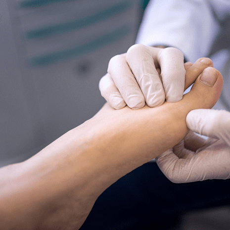 Specialist podiatry care for claw toes with silicone props, orthotics, strengthening, and footwear optimisation at Foot Foundation