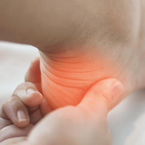 Foot Foundation podiatry treatment for Sever&rsquo;s disease and children&rsquo;s heel pain with orthotics, heel cups, and safe return-to-sport plans