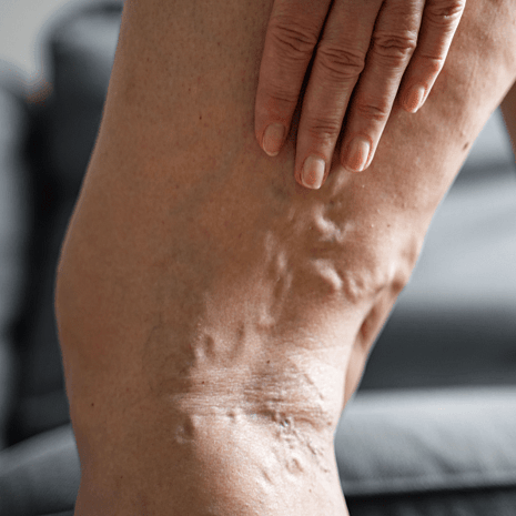 Foot Foundation podiatry care for vascular and circulatory leg issues with Doppler assessment, orthotics, and specialist referral