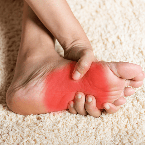 Podiatry care for accessory navicular syndrome with arch pain, footwear modification, and orthotics at Foot Foundation