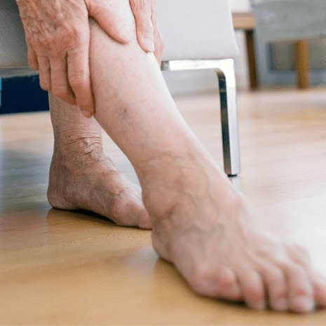 Specialist podiatry and physiotherapy care for leg pain including shin splints, stress fractures, calf injuries, and circulation issues at Foot Foundation