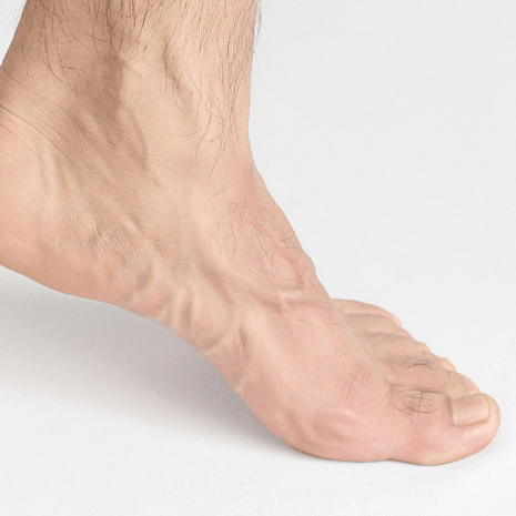 Foot Foundation podiatry treatment for hallux limitus and rigidus with orthotics, rocker footwear, and arthritis management