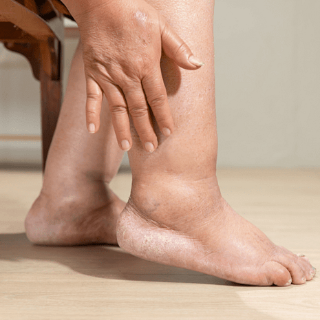 Foot Foundation podiatry treatment for ankle arthritis with orthotics, pain relief, and mobility restoration