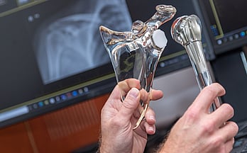 For upper limb surgery