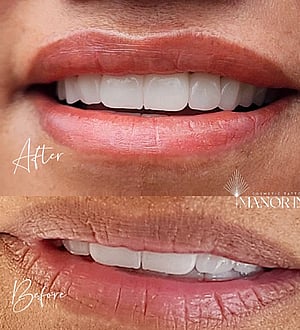 lip tattooing before and after photos by Manor Ink Hamilton