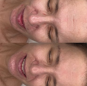 Observ Skin Analysis &ndash; Body Beautiful Retreat &ndash; Brisbane