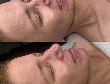 Observ Skin Analysis &ndash; Body Beautiful Retreat &ndash; Brisbane