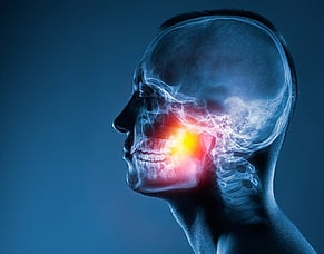 Struggling with Headaches? Osteopathy Can Help